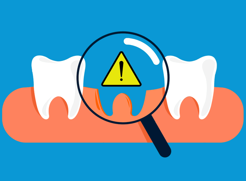 Denti mancanti: 6 conseguenze se non li sostituisci