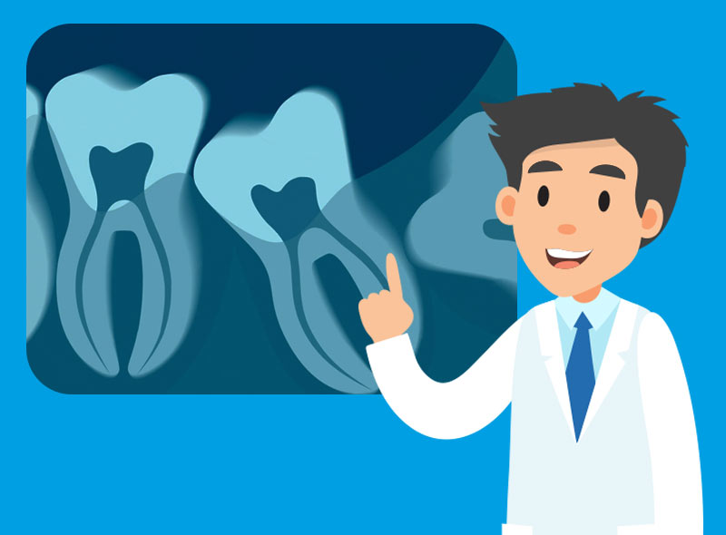 Parodontite: come diagnosticarla