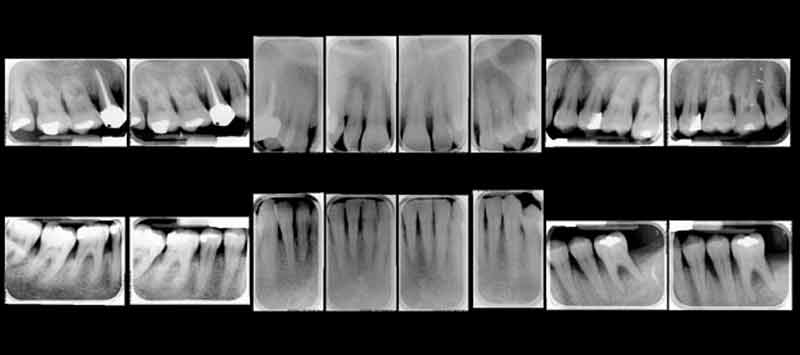 Esempio di status radiologico