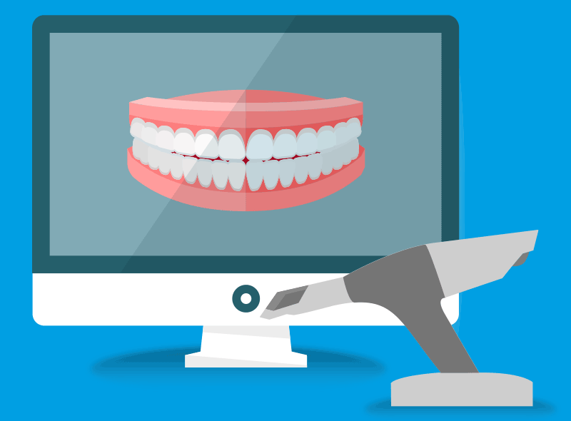 Impronta dentale digitale