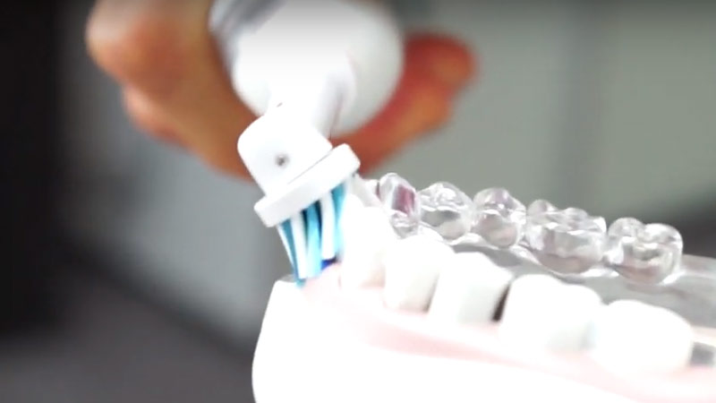 Setole di uno spazzolino elettrico inclinate di 45 gradi rispetto ai denti