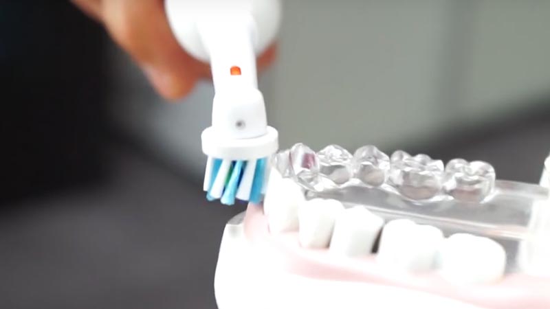 Le setole di uno spazzolino elettrico messe parallele rispetto ai denti