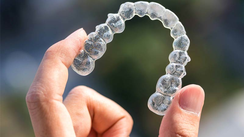 Mascherina Invisalign tenuta in mano