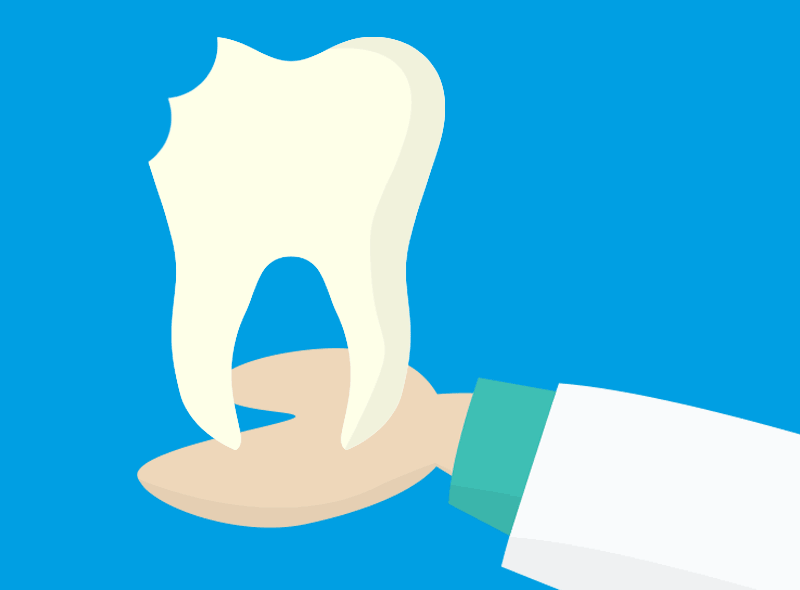 Dente rotto? Ecco cosa fare subito e rimedi