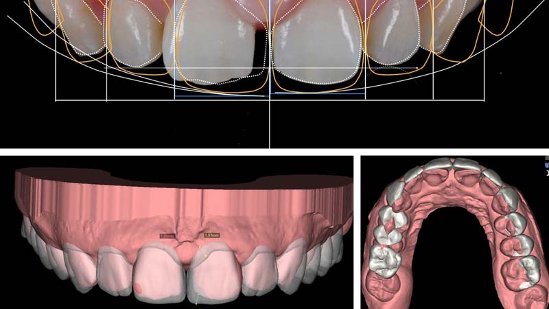 Schermata di un software di digital smile design