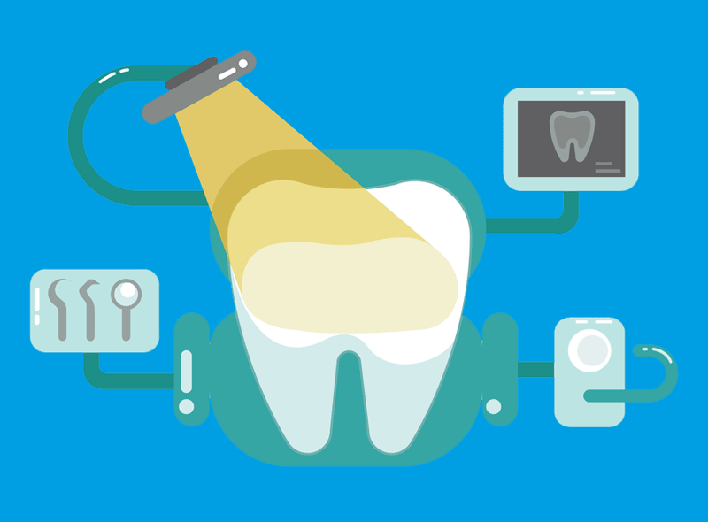 Impianti dentali: perché è importante il check-up implantare?